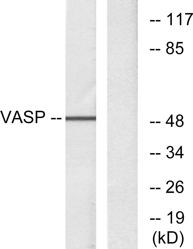 VASP Rabbit pAb ABZ1382