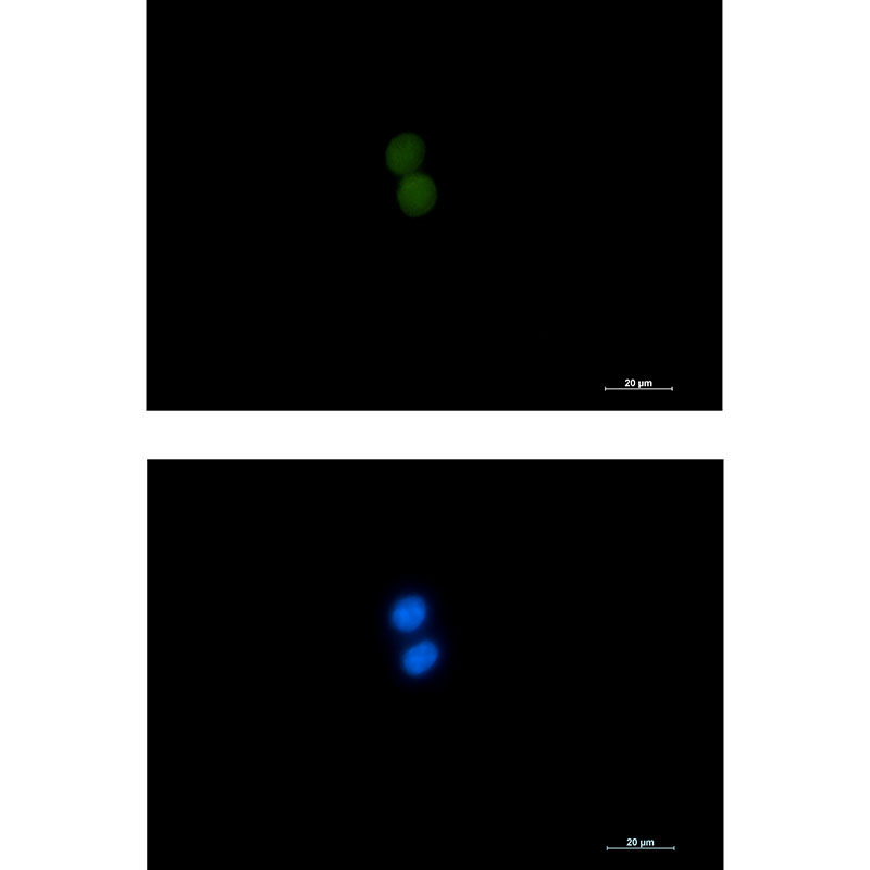 ASH2L Rabbit mAb ABZ1389