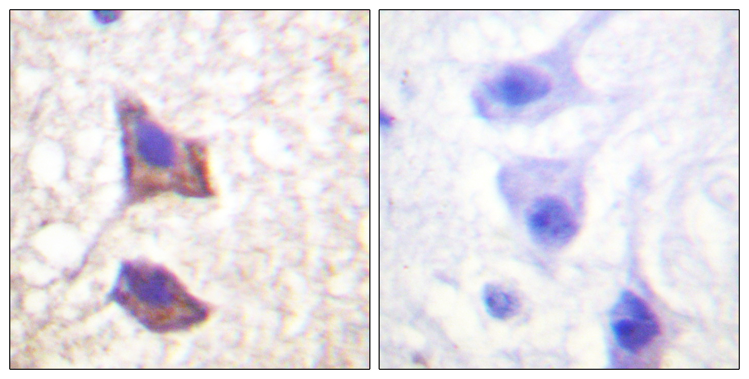 CD130 Rabbit pAb ABZ1394