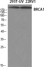 BRCA1 Rabbit pAb ABZ1396