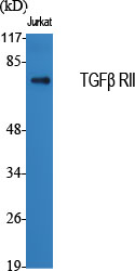 TGF beta Receptor II Rabbit pAb ABZ1399