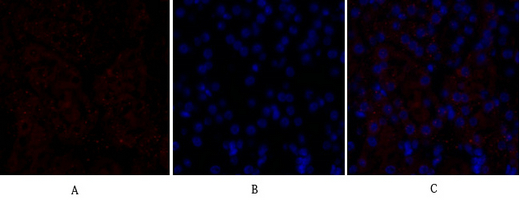 VEGF Receptor 2 Rabbit pAb ABZ1402