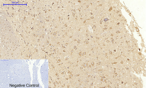VEGF Receptor 2 Rabbit pAb ABZ1402
