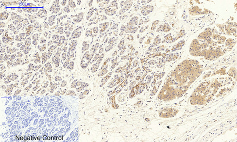 VEGF Receptor 2 Rabbit pAb ABZ1402