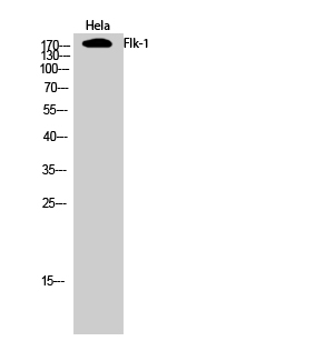 VEGF Receptor 2 Rabbit pAb ABZ1402
