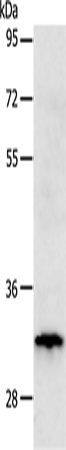 TIMP3 Rabbit pAb ABZ1403