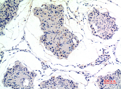 Thrombospondin 2 Rabbit pAb ABZ1404