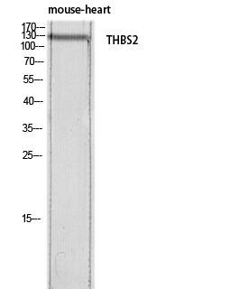 Thrombospondin 2 Rabbit pAb ABZ1404