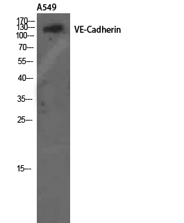 VE Cadherin Rabbit pAb ABZ1405