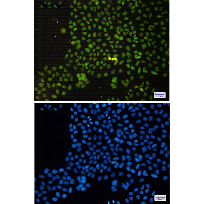 ASH2L Rabbit mAb ABZ1407
