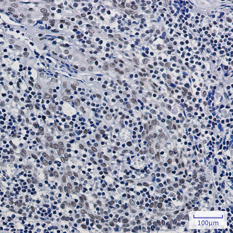 ASH2L Rabbit mAb ABZ1407