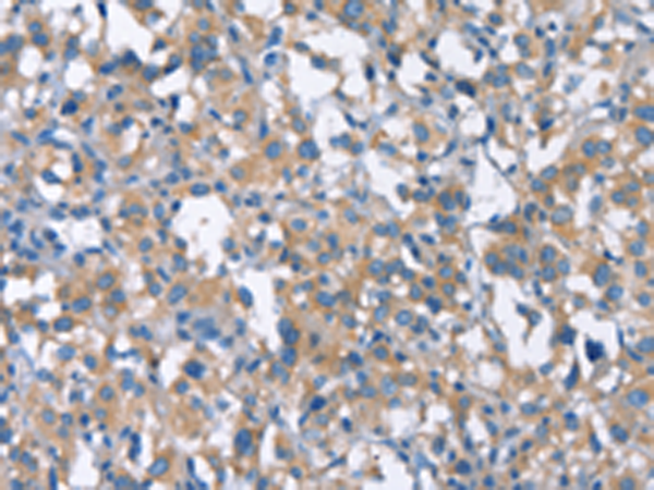 CDC25A Rabbit pAb ABZ1410
