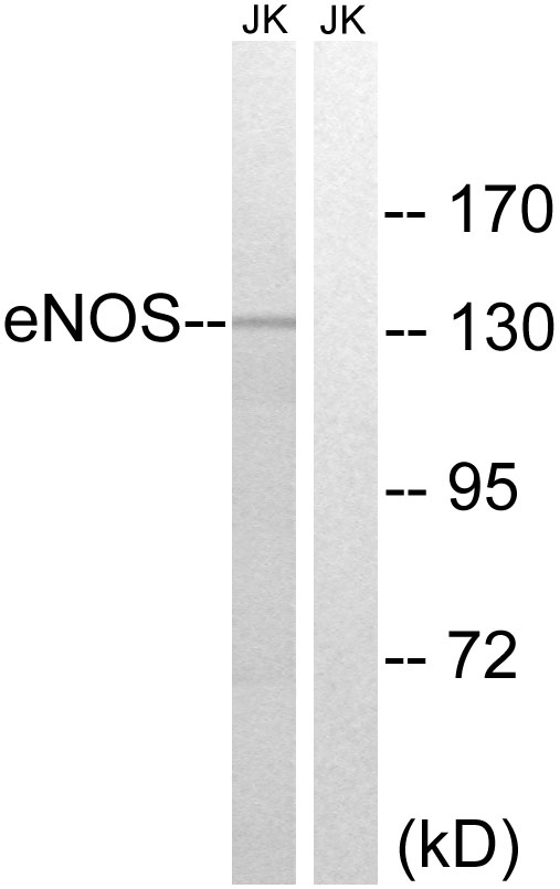 eNOS Rabbit pAb ABZ1411