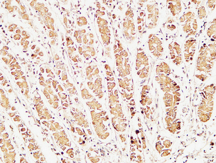 Caspase 1 Rabbit pAb ABZ1412