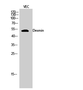 Desmin Rabbit pAb ABZ1417
