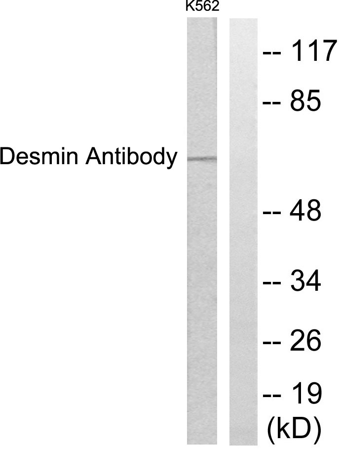 Desmin Rabbit pAb ABZ1417