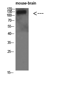 Collagen IV alpha 1 Rabbit pAb ABZ1428