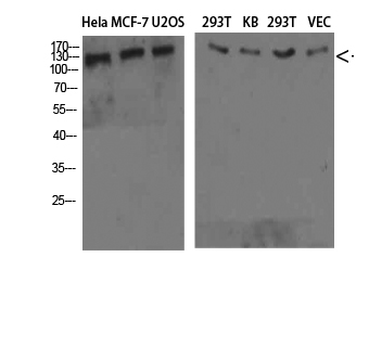 Collagen IV alpha 1 Rabbit pAb ABZ1429