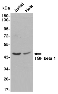 TGF beta 1 Rabbit pAb ABZ1436
