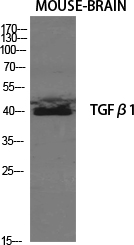 TGF beta 1 Rabbit pAb ABZ1436