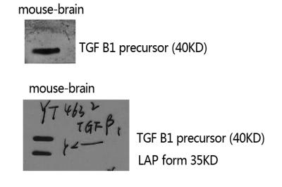 TGF beta 1 Rabbit pAb ABZ1436