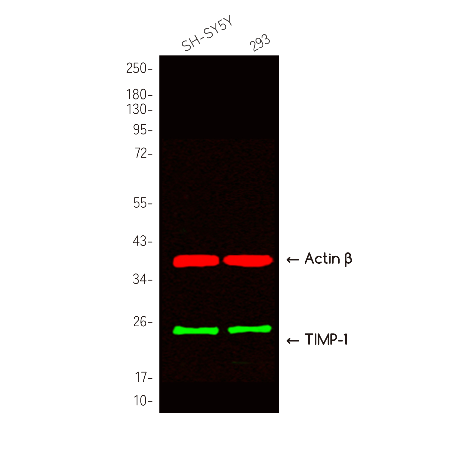 TIMP1 Rabbit pAb ABZ1441