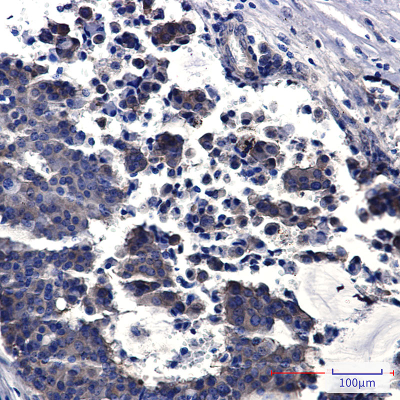 PPCEL Rabbit mAb ABZ1442