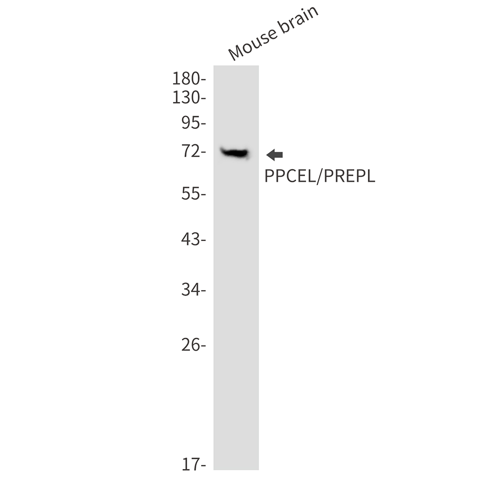 PPCEL Rabbit mAb ABZ1442