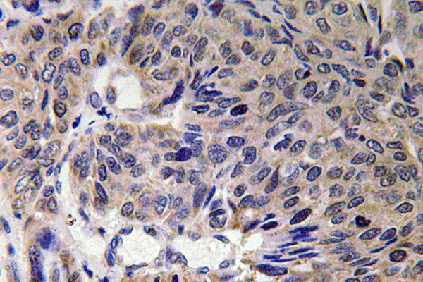 Mitofusin 2 Rabbit pAb ABZ1445