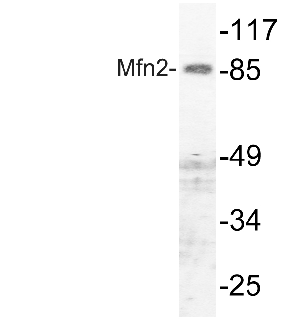 Mitofusin 2 Rabbit pAb ABZ1445