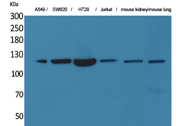 CD133 Rabbit pAb ABZ1446