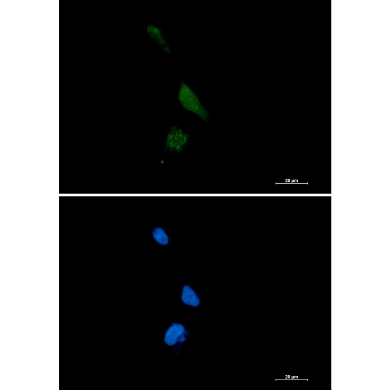 PPCEL Rabbit mAb ABZ1447