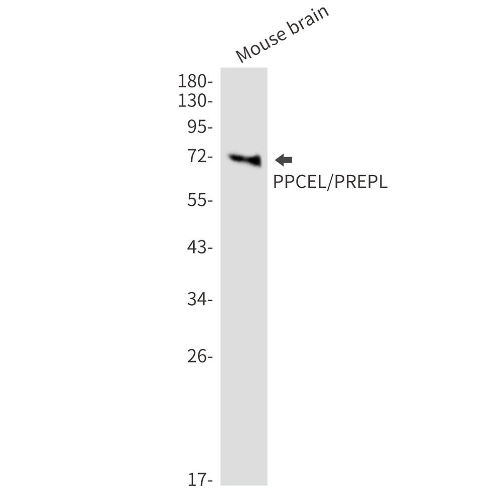PPCEL Rabbit mAb ABZ1447