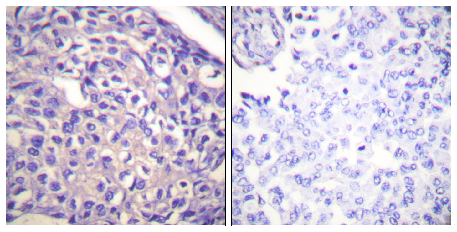 Myosin Phosphatase Rabbit pAb ABZ1455