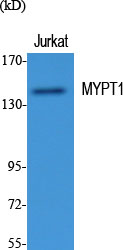 Myosin Phosphatase Rabbit pAb ABZ1455