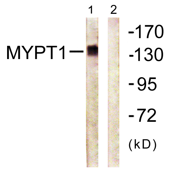 Myosin Phosphatase Rabbit pAb ABZ1455