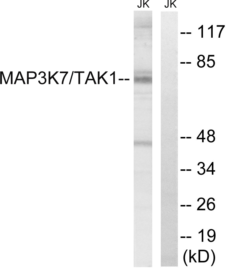 TAK1 Rabbit pAb ABZ1456