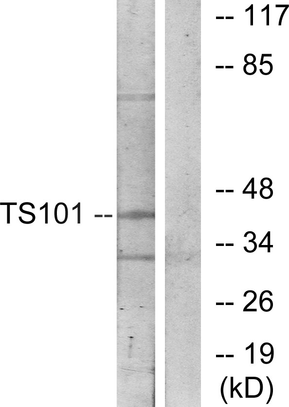 TSG101 Rabbit pAb ABZ1457