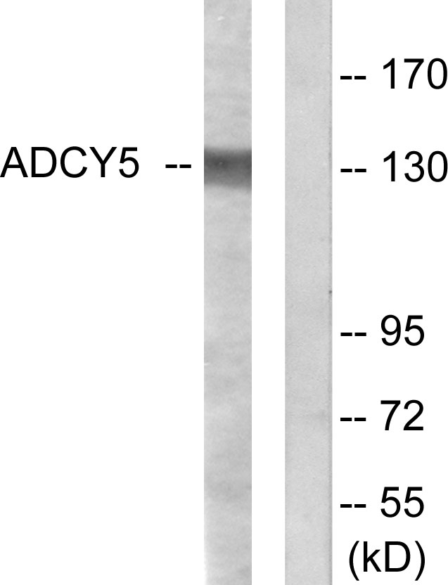 ADCY5/6 Rabbit pAb ABZ1459