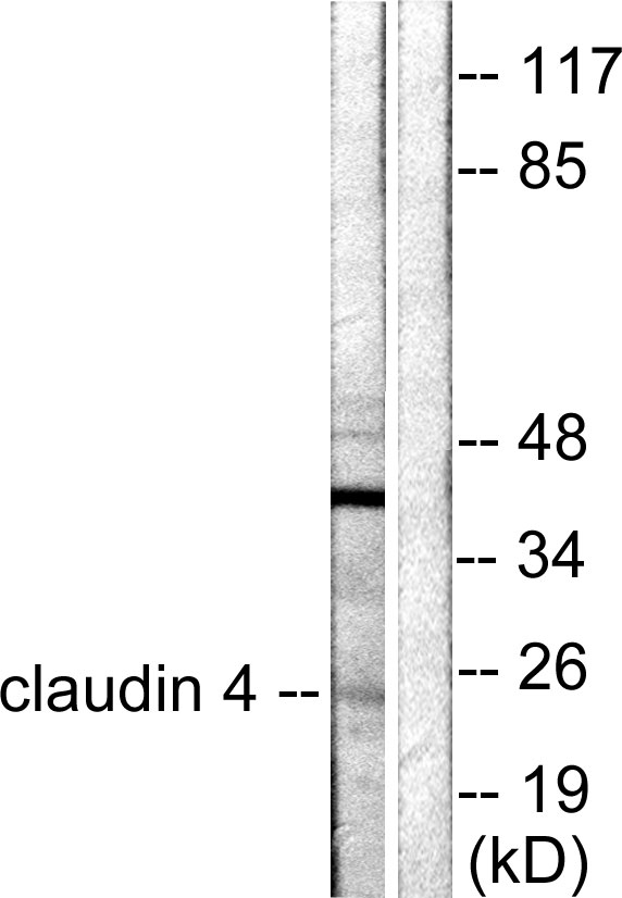 Claudin 4 Rabbit pAb ABZ1461