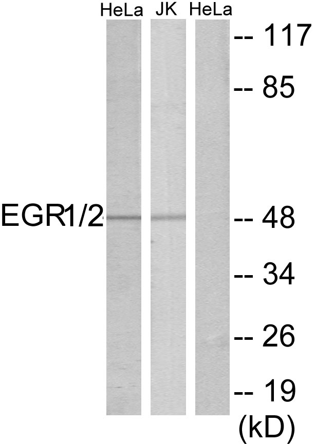 EGR2 Rabbit pAb ABZ1463