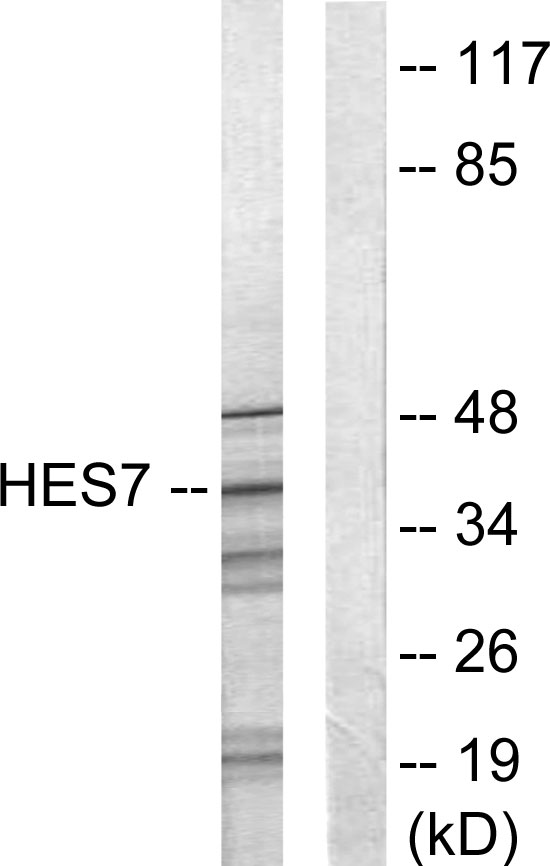 HEXIM1 Rabbit pAb ABZ1465