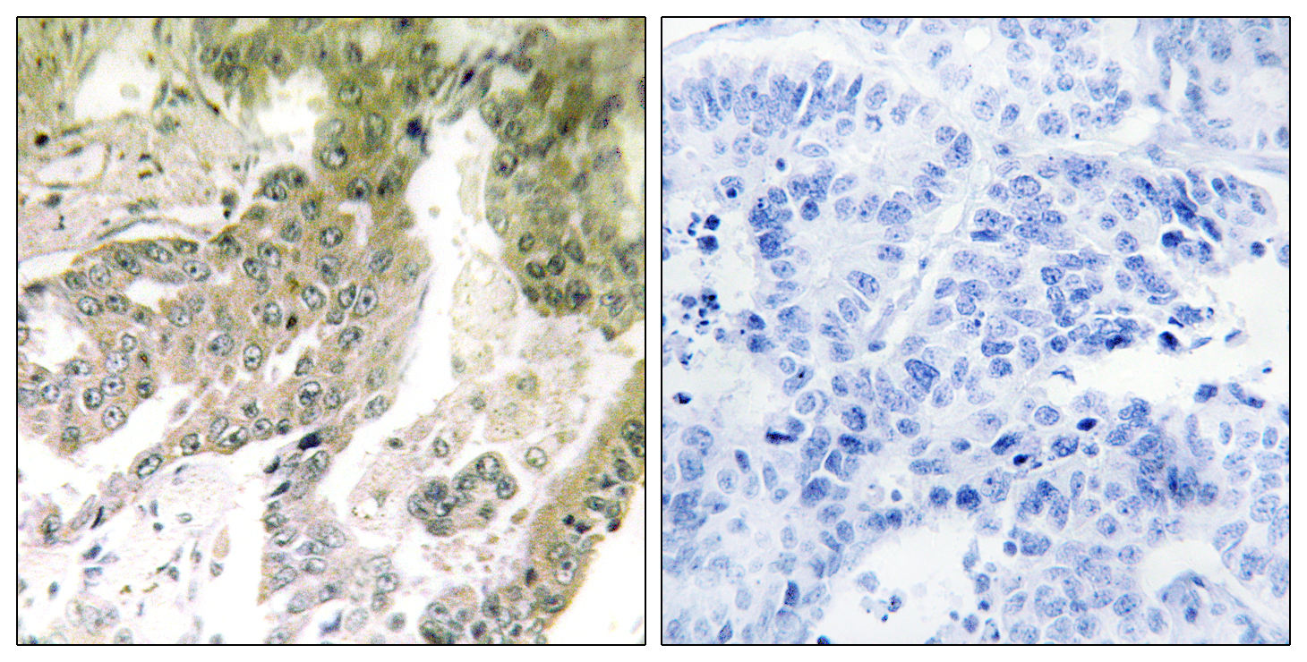 Laminin alpha 5 Rabbit pAb ABZ1466
