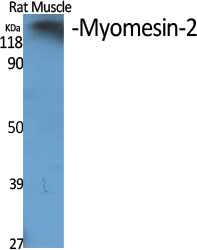 MYOM2 Rabbit pAb ABZ1469
