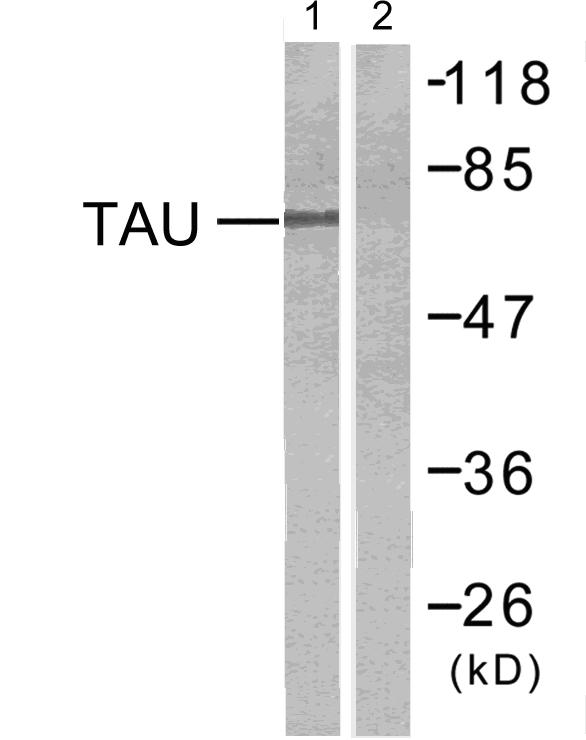 Tau Rabbit pAb ABZ1472