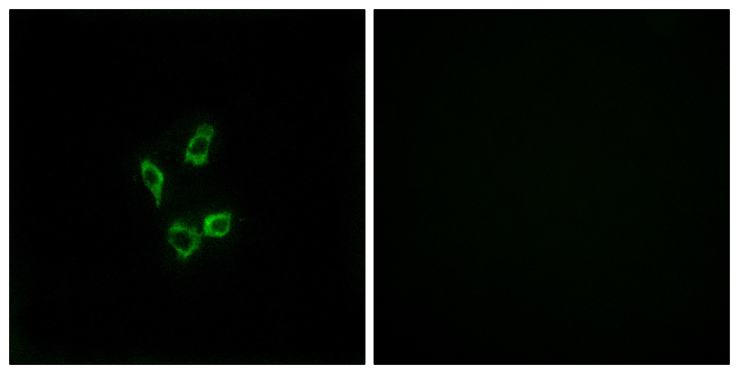 Cytochrome P450 4Z1 Rabbit pAb ABZ1478