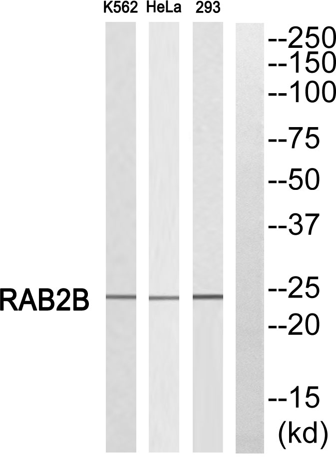 Rab2B Rabbit pAb ABZ1482