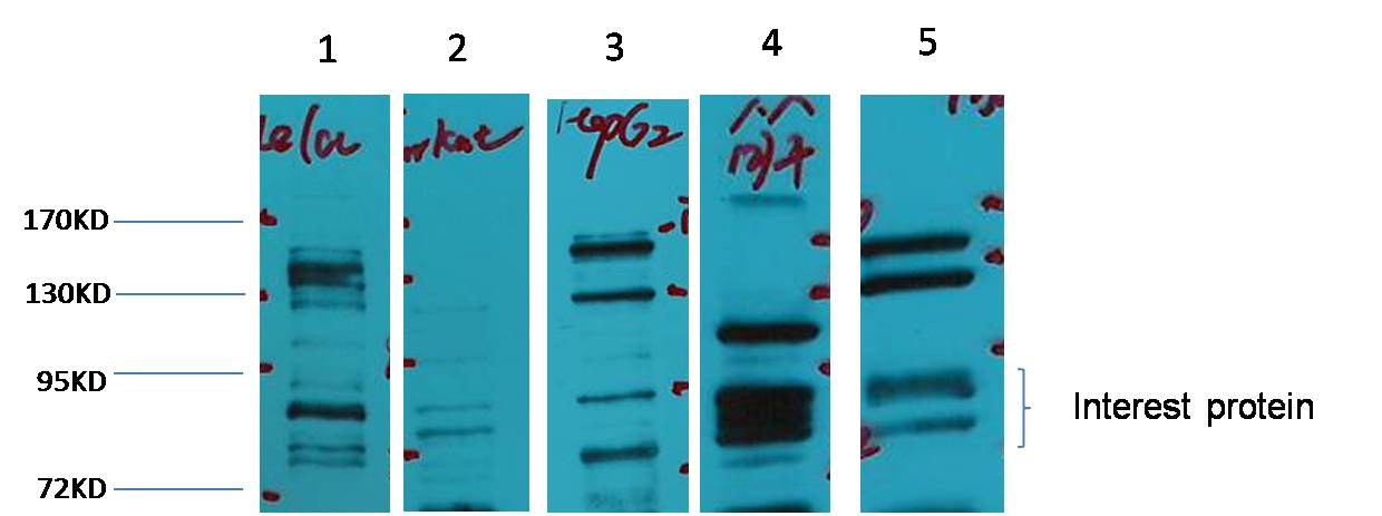 Glucocorticoid Receptor Rabbit pAb ABZ1487