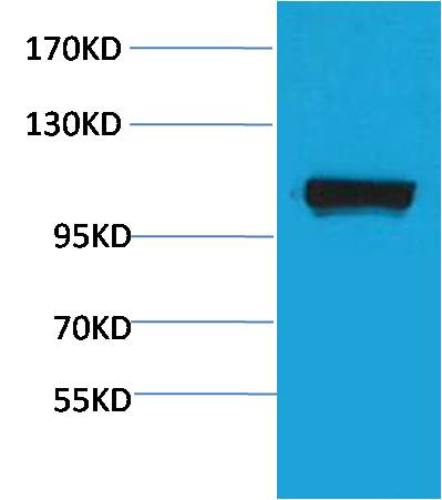 Pepsinogen II/PGC Rabbit pAb ABZ1491