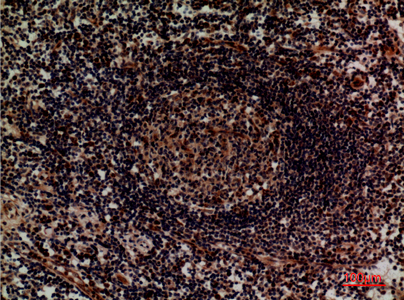 Integrin alpha 4 Rabbit pAb ABZ1506